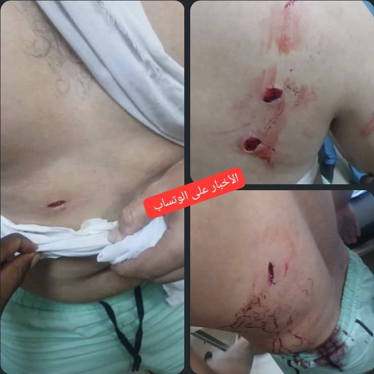 Néma : un commerçant agressé à l’arme blanche lors d’une attaque en plein jour
